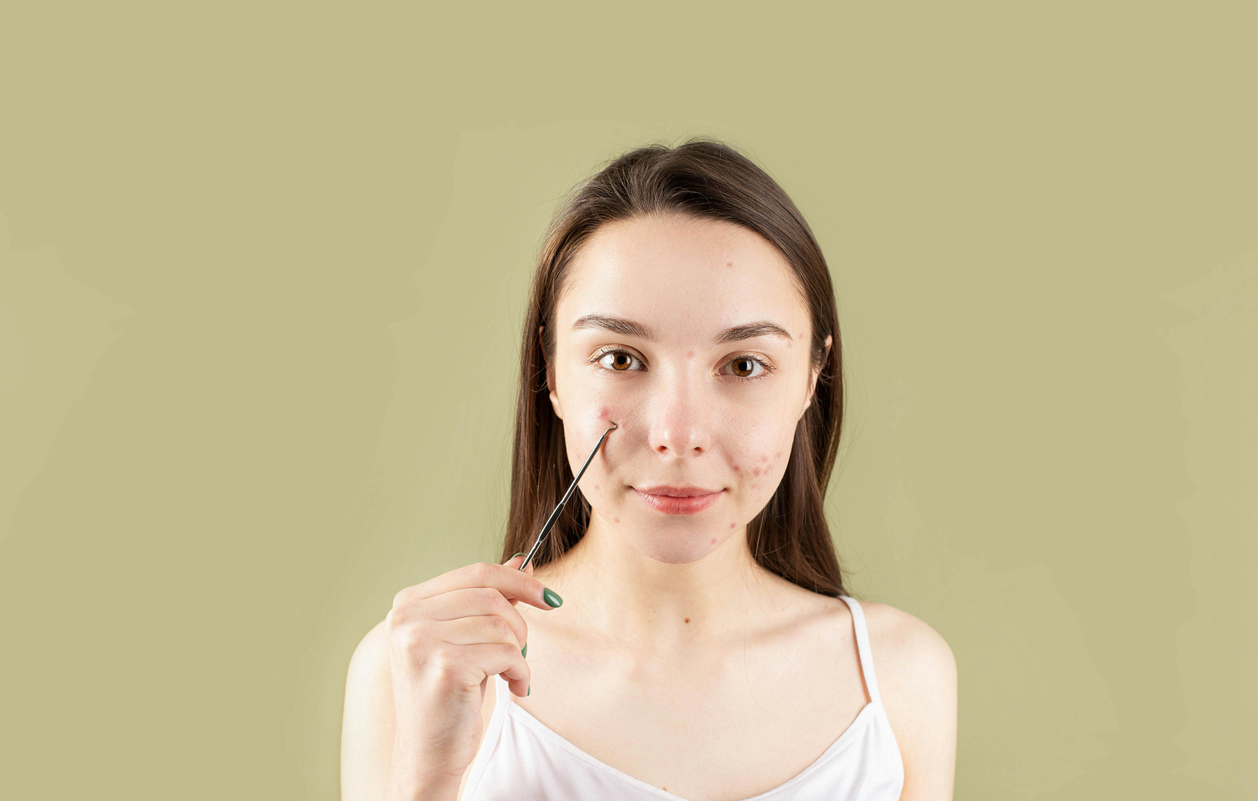 Как да се справим с акнето? Полезни съвети за чиста и здрава кожа